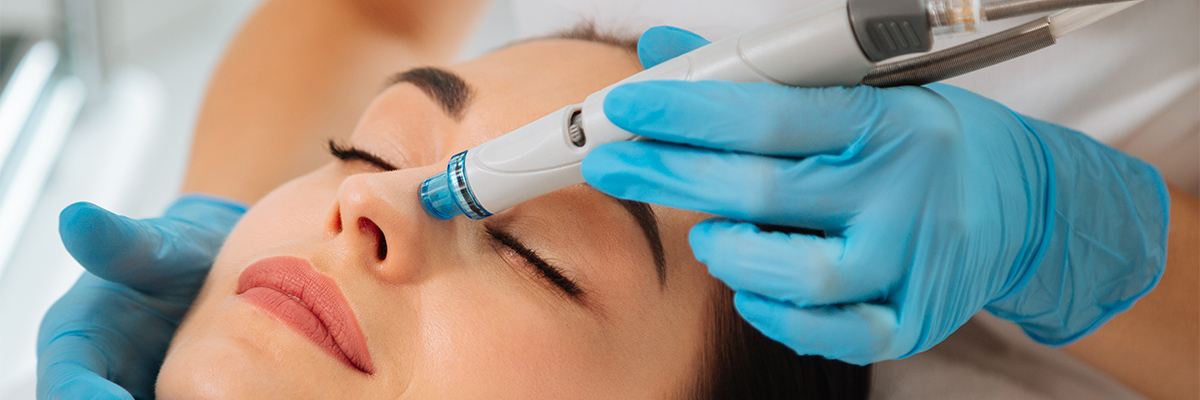 Frau bekommt HydraFacial Behandlung als Symbol für tiefenreine Haut