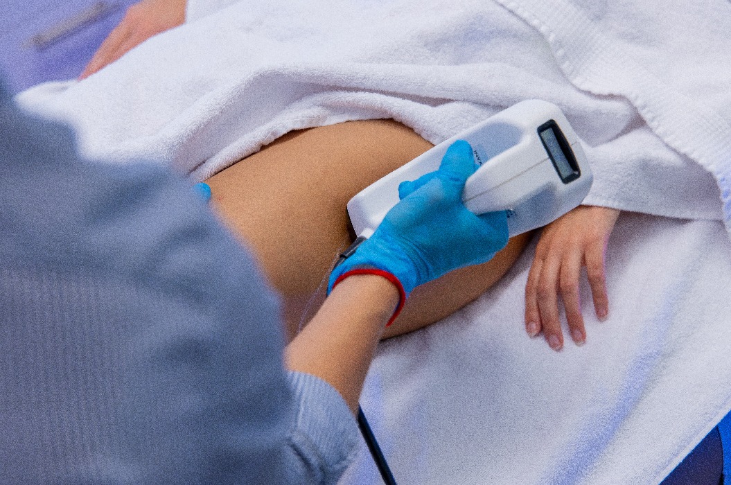 Haarentfernung durch Laser Epilation